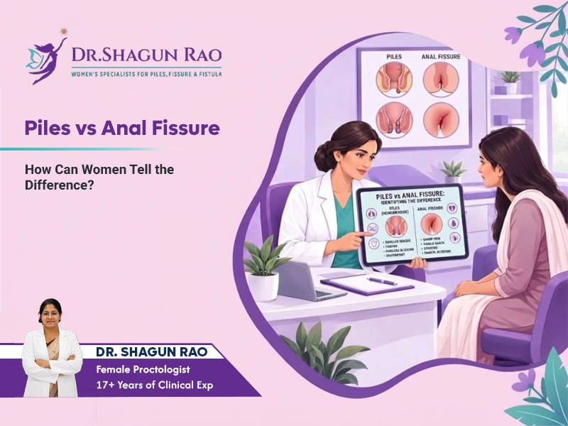 Piles vs Anal Fissure